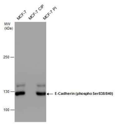 Western Blot: E-Cadherin [p Ser838, p Ser840] Antibody [NBP3-12922]